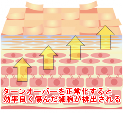 ターンオーバーの正常化